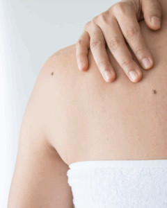 Medical Dermatology Services in Kerrville, TX