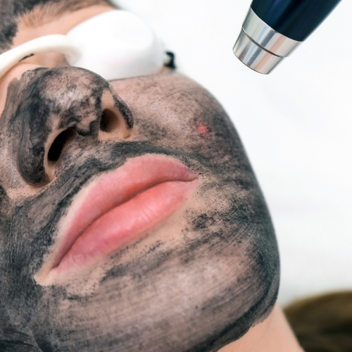 Hollywood Spectra AcnePeel